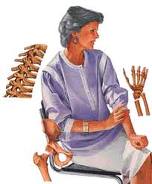 osteoporoza deformacije